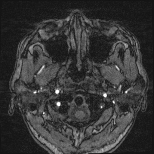 Click on the Serie image to view the images of VILLANUEVA, WILLIAM A.